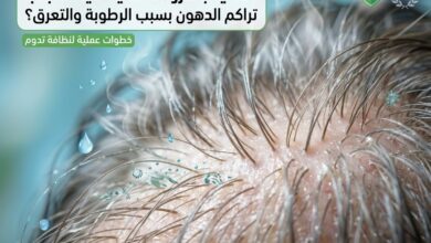 فروة رأس دهنية تعاني من تراكم الزيوت والتعرق بسبب الرطوبة